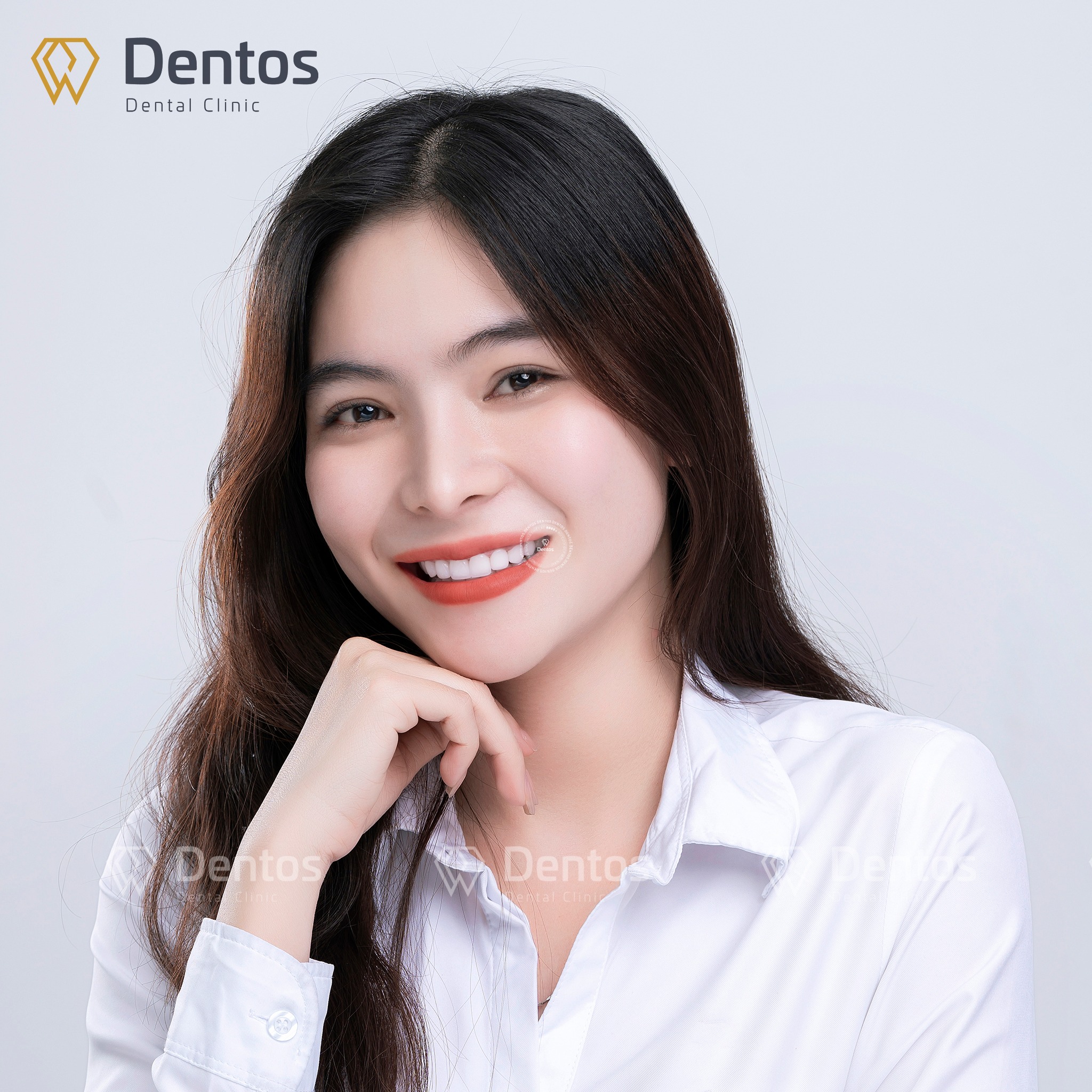 Răng sứ Orodent nổi bật với thẩm mỹ tự nhiên, tinh tế